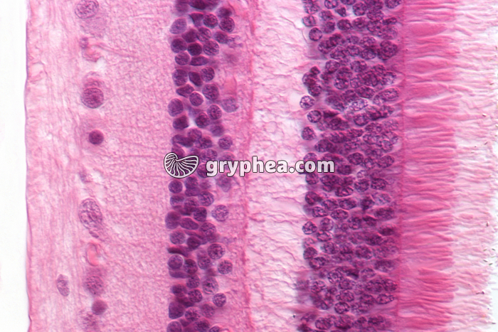 Rétine CT x200 - gryphea.org